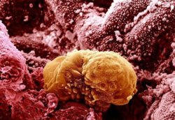 Embryo implantation: symptoms, signs, timeline and process